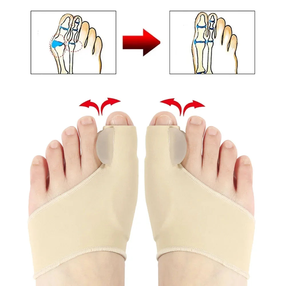 AlignToes -Gel Bunion Corrector